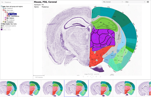 Allen Brain Atlas (Interactive Atlas Viewer / 3D Viewer) interactive ...